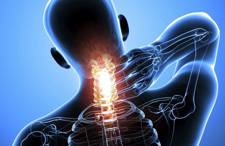 nyaki osteochondrosis fájdalom mit kell tenni fájdalom a csípőízületben